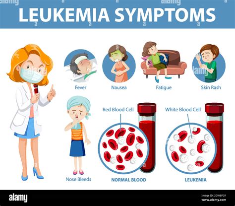 sintomas leucemia